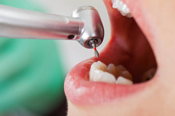 Best Weekend Emergency Dentist in Burke, VA
